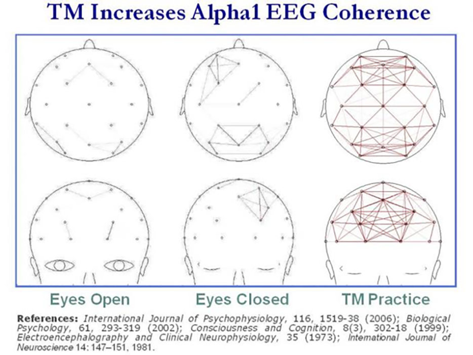 EEG Chart